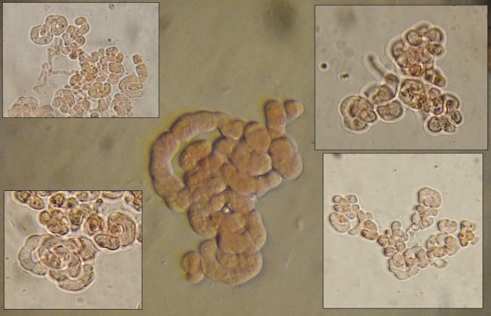 Illosporiopsis (spores).jpg