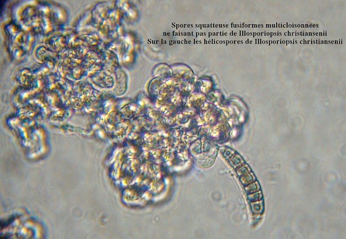 Illosporiopsis 2(spores).jpg