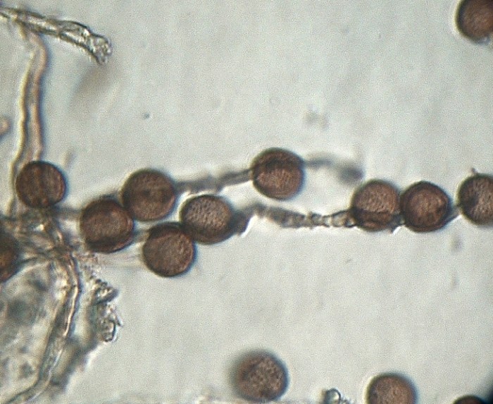Myxomycète rose-spores et capillitrium_101110.jpg