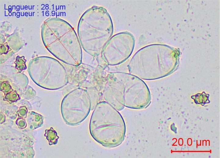 Cheilocystides ovoïdes à paroi épaisse de 1,5-3 µ